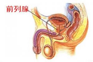 前列腺炎问题