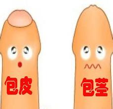 包皮包茎